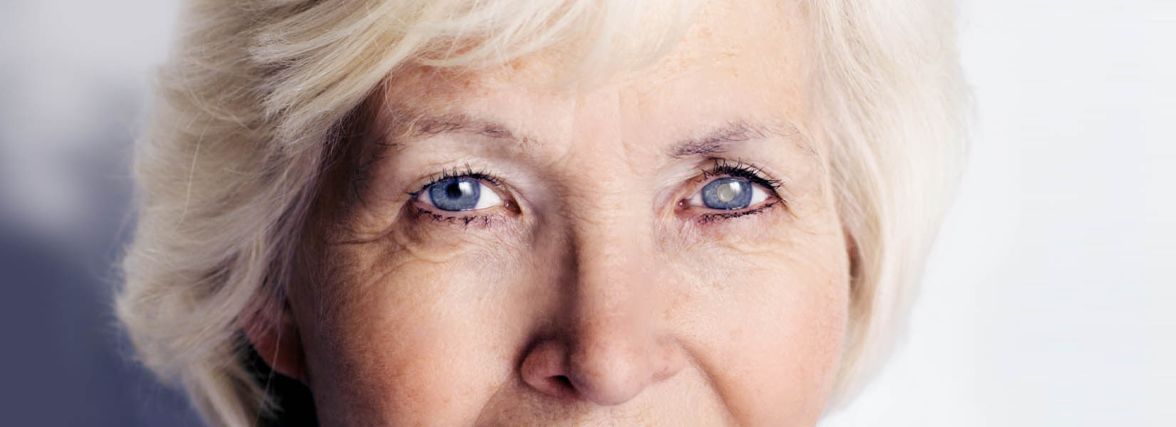 Cataract Surgery in Oakdale